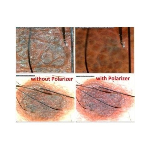 Microscopio digital  DermaScope Polarizer
