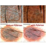 Microscopio digital  DermaScope Polarizer