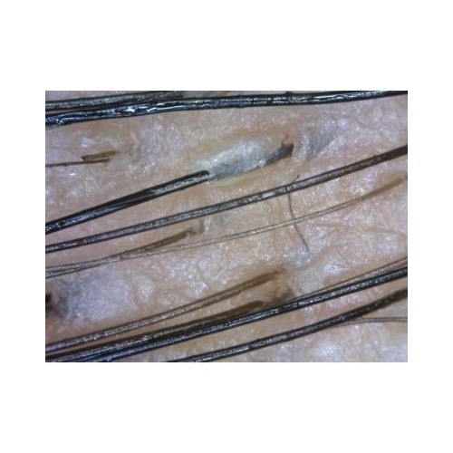 DermaScope Polarizer