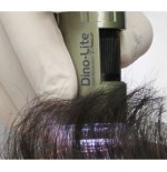 DermaScope Polarizer